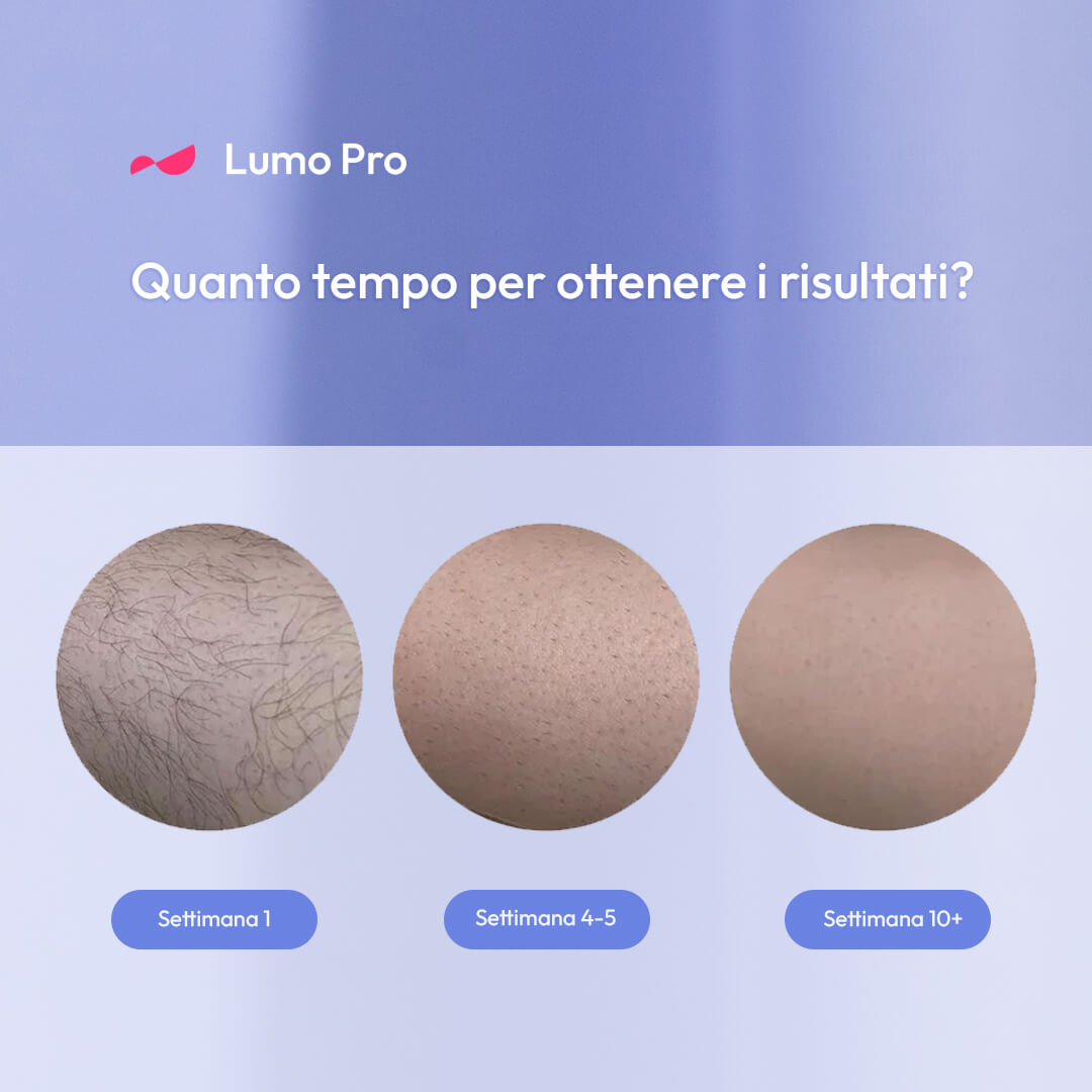 Lumo Pro